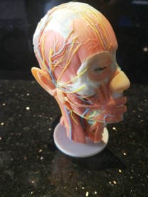 3D打印——醫療術前演練